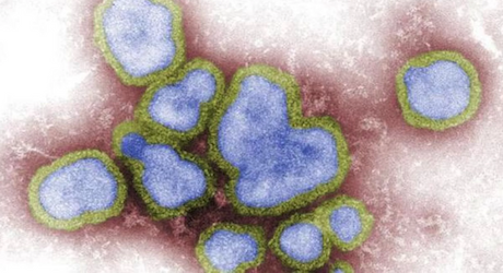 Cuidados Clínicos na Síndrome Respiratória Aguda Grave - 2020